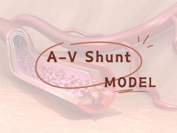 Mô hình shunt AV